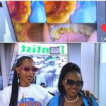 Video: Watch as Spice Diana’s gets dental surgery