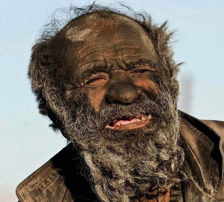 PHOTO: World’s dirtiest man dies at 94 years