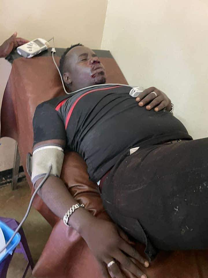 Here is Mbazira Tonny’s update on his health condition after an accident