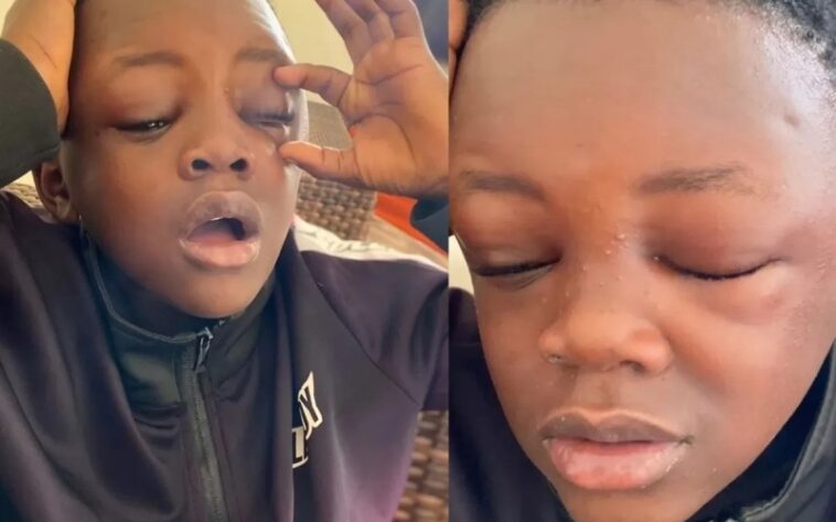 What is eating Champion Gudo’s Face?